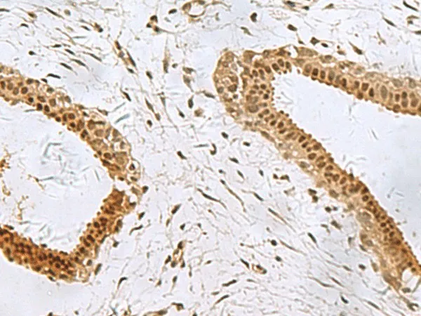 PCBD1 Polyclonal Antibody - image 1