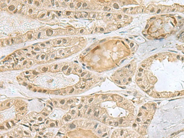 PCBD1 Polyclonal Antibody - image 2
