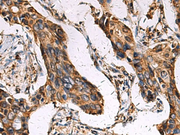 ECM1 Polyclonal Antibody - image 1