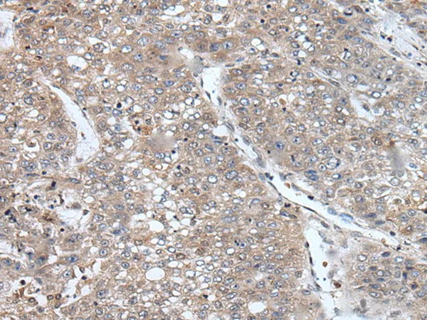 BORA Polyclonal Antibody - image 1