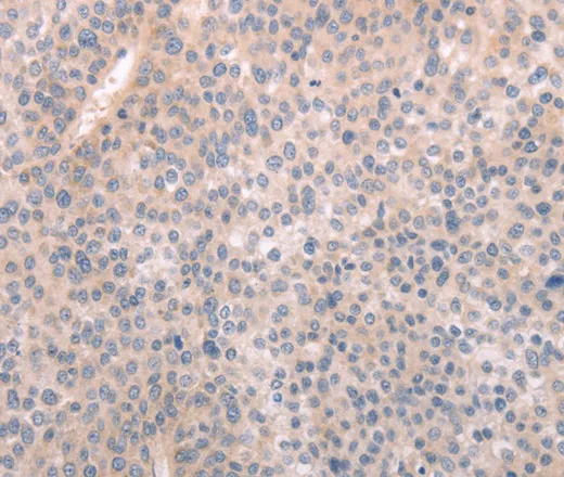 ABCF1 Polyclonal Antibody - image 1