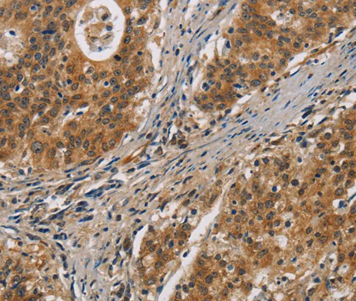 IL17D Polyclonal Antibody - image 1