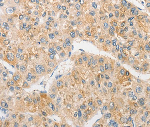 TLR5 Polyclonal Antibody - image 1
