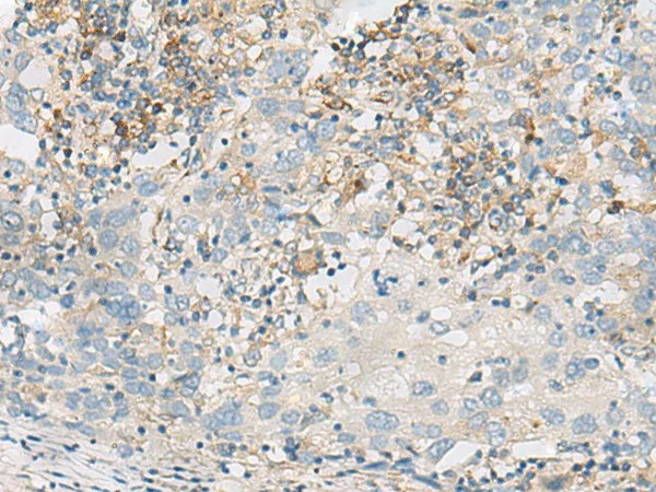 FERD3L Polyclonal Antibody - image 1