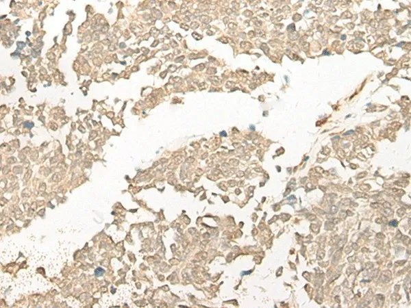 COMT Polyclonal Antibody - image 1