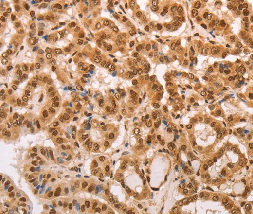 HEXIM1 Polyclonal Antibody - image 1
