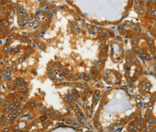 GOT1 Polyclonal Antibody - image 1