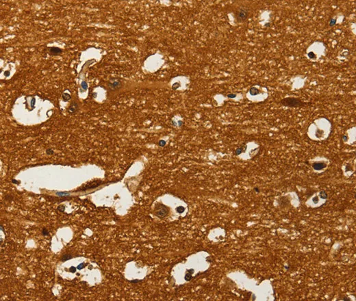 GOT1 Polyclonal Antibody - image 2
