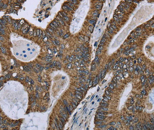 GOT2 Polyclonal Antibody - image 1
