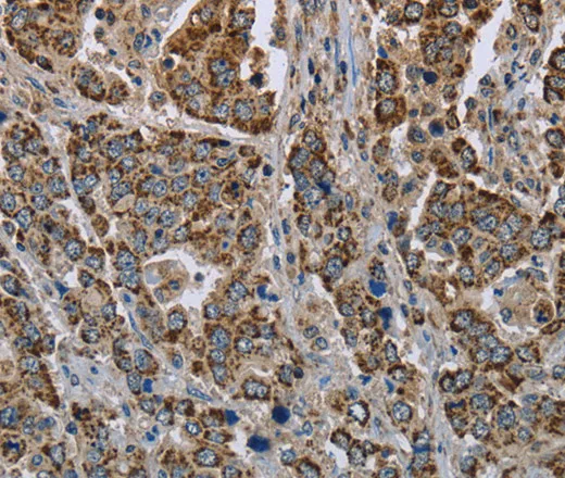 GOT2 Polyclonal Antibody - image 2