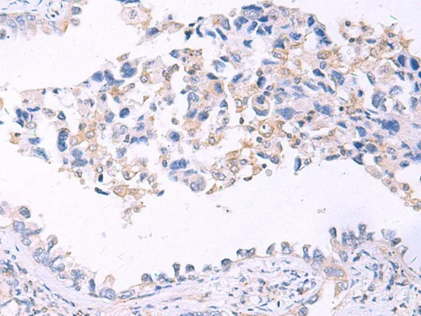 GRIA2 Polyclonal Antibody - image 1