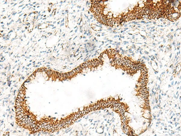 ORC4 Polyclonal Antibody - image 1