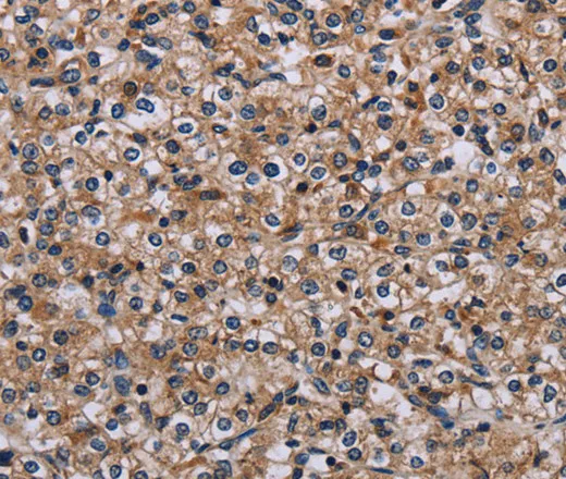 IPO4 Polyclonal Antibody - image 1