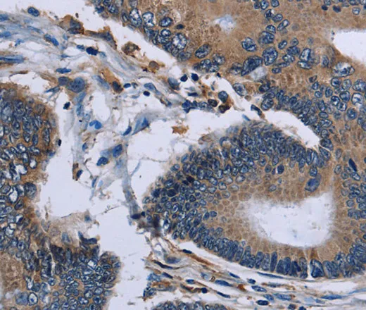 IPO4 Polyclonal Antibody - image 2