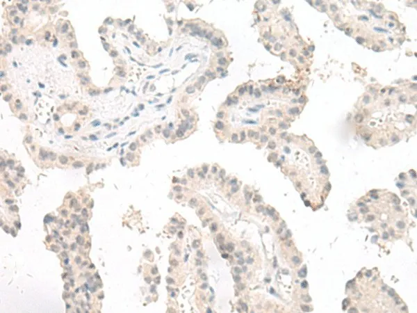 GHDC Polyclonal Antibody - image 1
