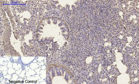 Α-SMA Polyclonal Antibody - image 1