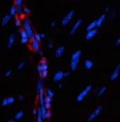 Α-SMA Polyclonal Antibody - image 2