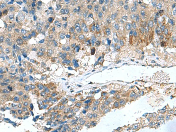 HSD11B1 Polyclonal Antibody - image 1