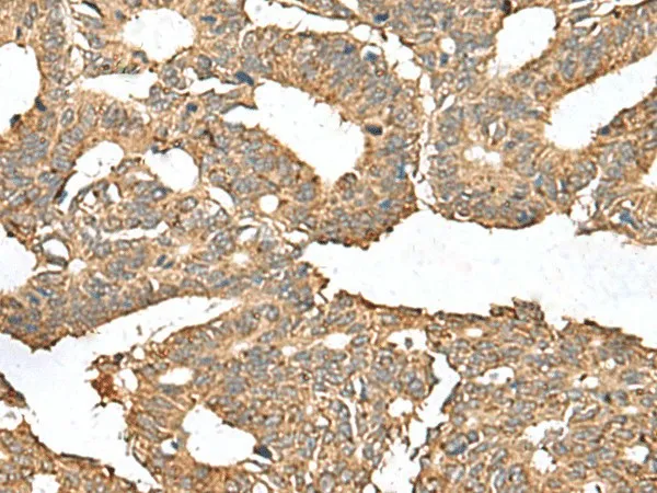 AHNAK Polyclonal Antibody - image 1