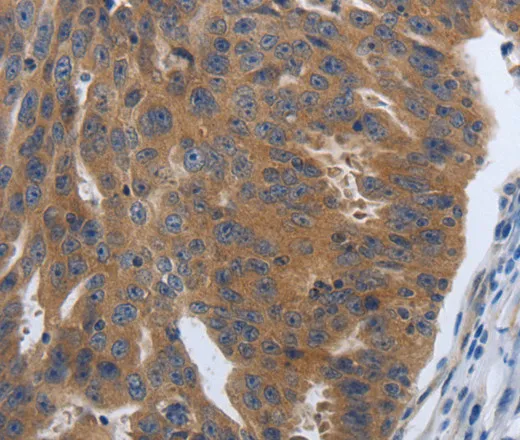 PDGFA Polyclonal Antibody - image 1