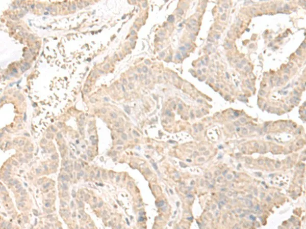 ERGIC3 Polyclonal Antibody - image 1