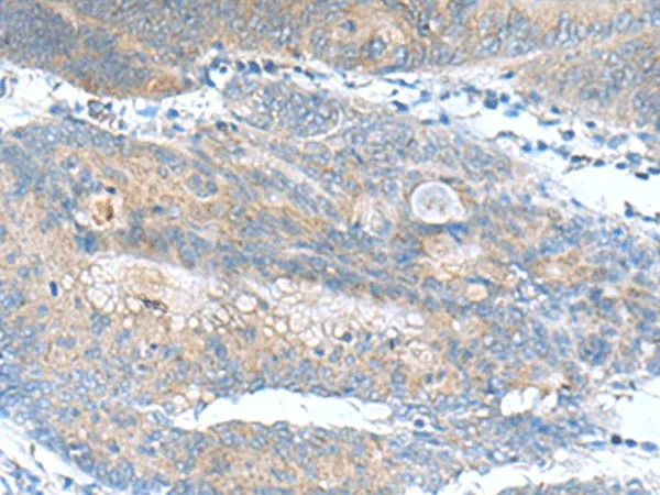 JOSD1 Polyclonal Antibody - image 1