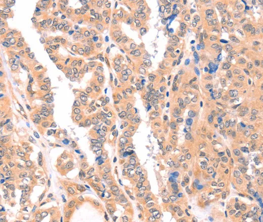 APBA2 Polyclonal Antibody - image 1