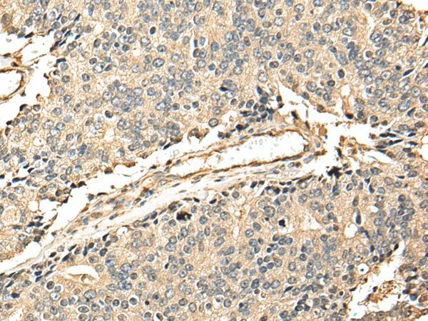 EEF1E1 Polyclonal Antibody - image 1