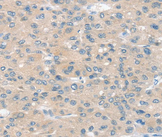 SLIT2 Polyclonal Antibody - image 1