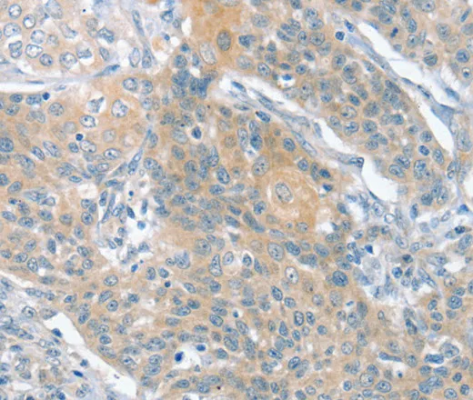 SLIT2 Polyclonal Antibody - image 2