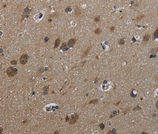 GSTA3 Polyclonal Antibody - image 1