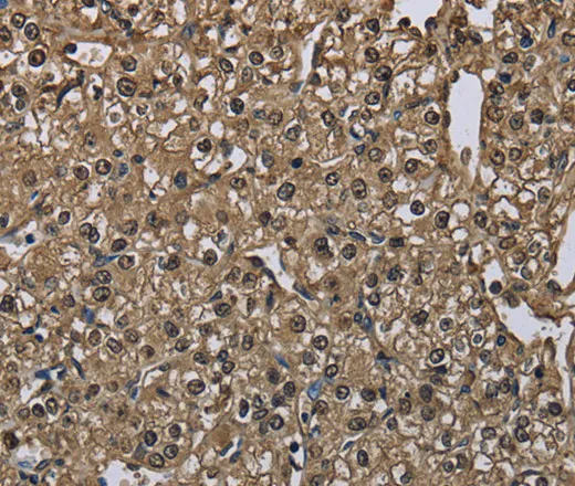 GSTA3 Polyclonal Antibody - image 2