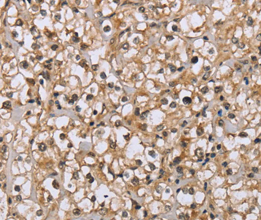 DLD Polyclonal Antibody - image 1