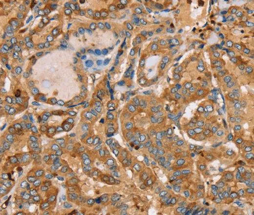 PLS3 Polyclonal Antibody - image 1