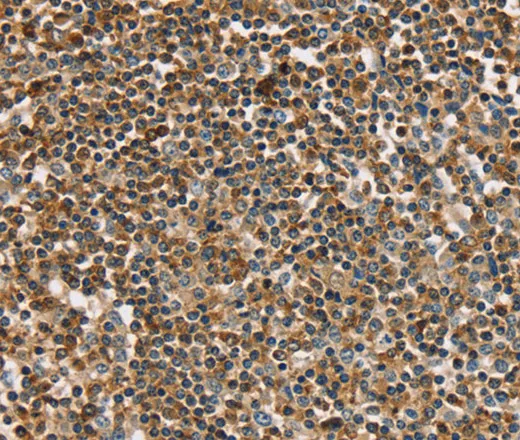 PLS3 Polyclonal Antibody - image 2