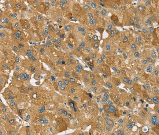 TRIM34 Polyclonal Antibody - image 1