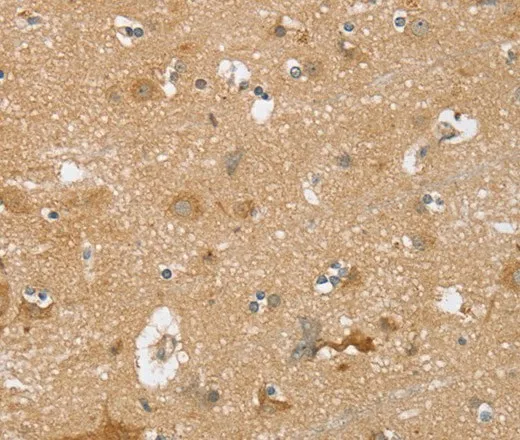 TRIM34 Polyclonal Antibody - image 2