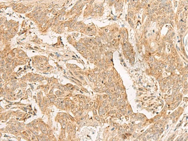 ADGRF1 Polyclonal Antibody - image 1