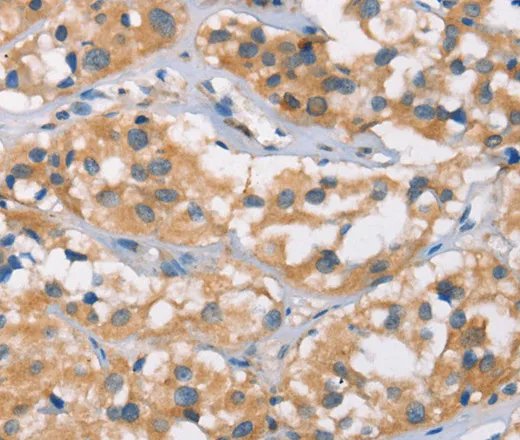 DSC2 Polyclonal Antibody - image 1