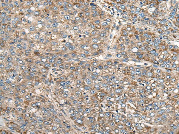 CADM2 Polyclonal Antibody - image 1