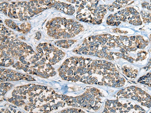 CADM2 Polyclonal Antibody - image 2