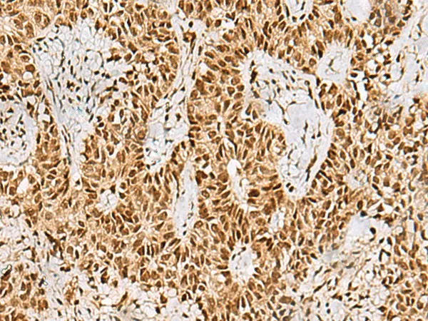 PHF5A Polyclonal Antibody - image 1