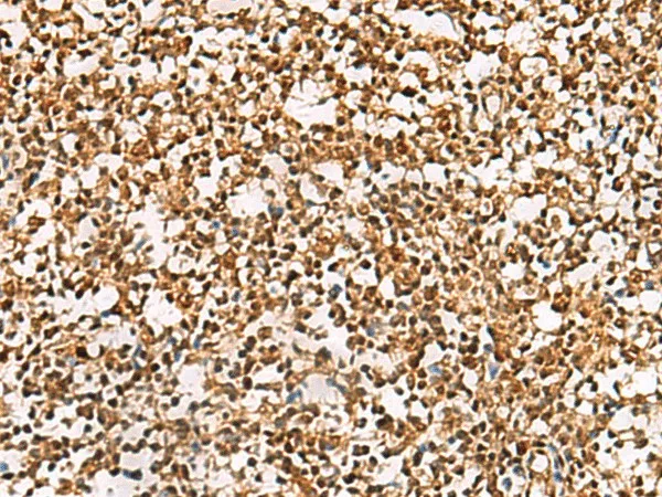PHF5A Polyclonal Antibody - image 2
