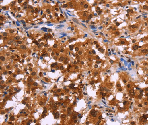 USP2 Polyclonal Antibody - image 1
