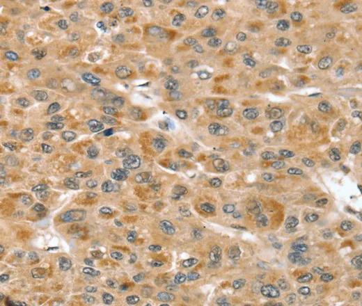RNH1 Polyclonal Antibody - image 1
