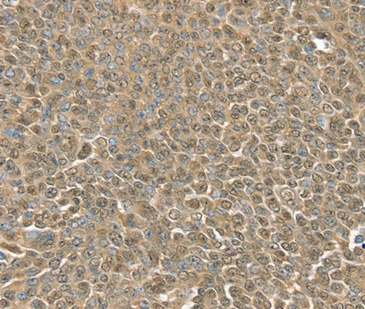 RNH1 Polyclonal Antibody - image 2