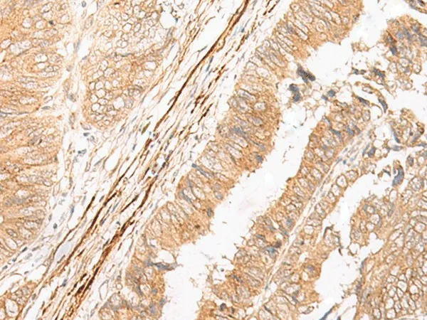 EPS15 Polyclonal Antibody - image 1