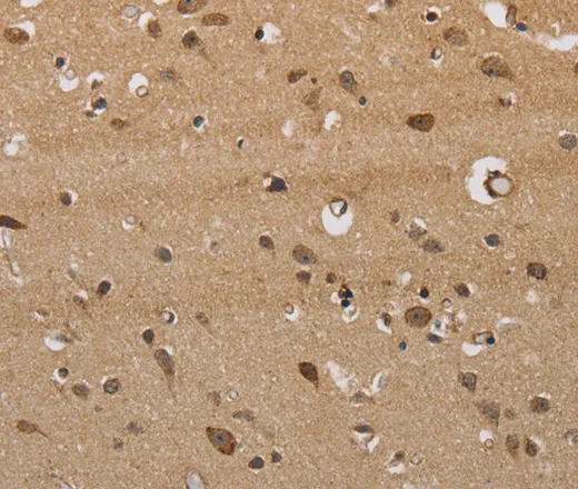 ITPR3 Polyclonal Antibody - image 1
