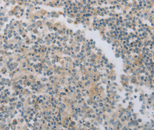 MAGED1 Polyclonal Antibody - image 1