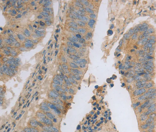 MAGED1 Polyclonal Antibody - image 2